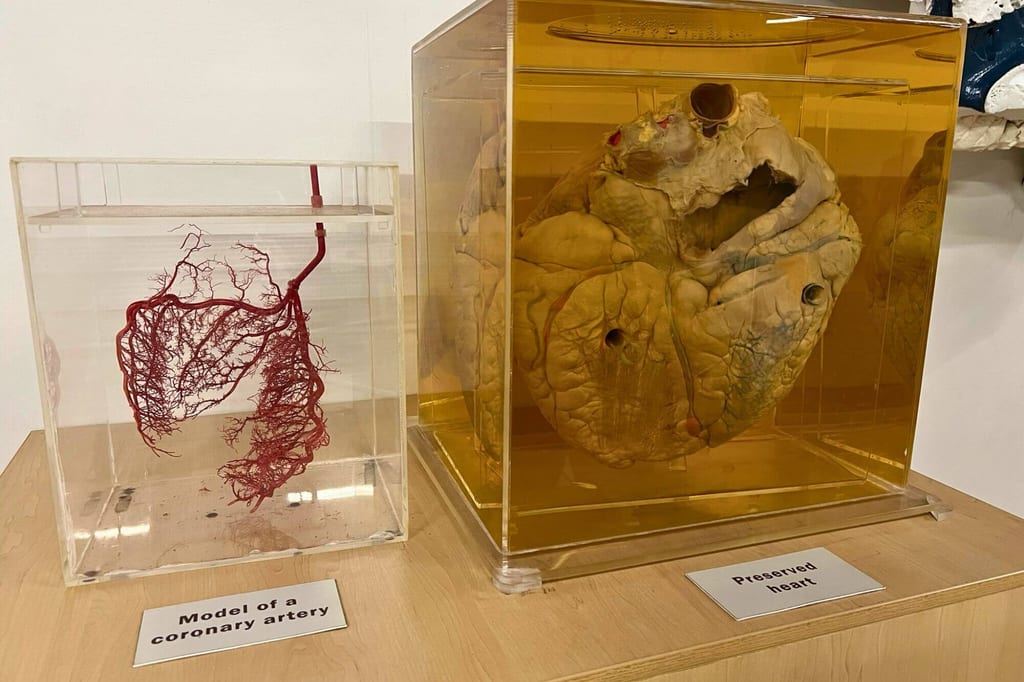 Medizinische Exponate: rotes Gefäßgussmodell und konserviertes Herz in Acrylbehältern